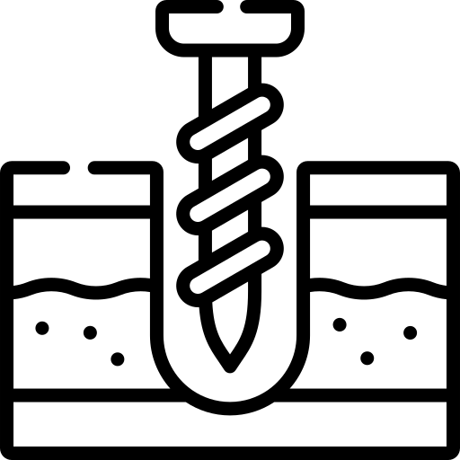 Asfalt Kesme